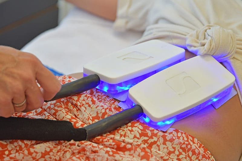 Cryo4s-Applikatoren während der Behandlung